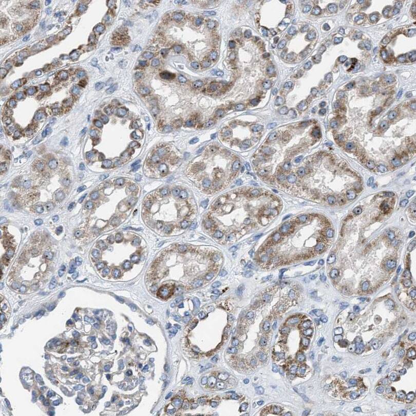 Staining of human kidney shows moderate to strong cytoplasmic positivity in cells in tubules.