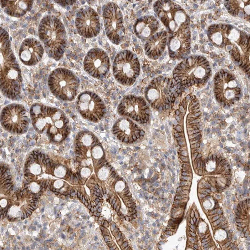 Immunohistochemistry-Paraffin Two pore calcium channel protein 2 Antibody - BSA Free