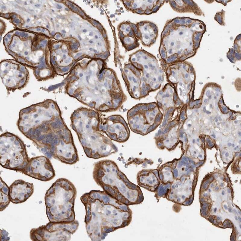 Immunohistochemistry-Paraffin Two pore calcium channel protein 2 Antibody - BSA Free