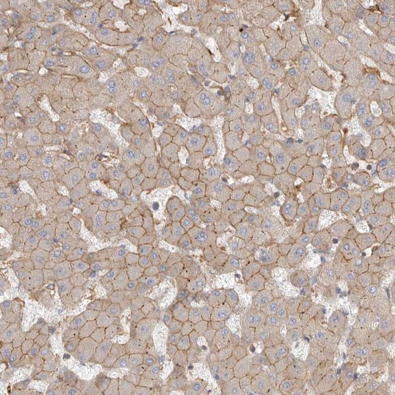 Immunohistochemistry-Paraffin Two pore calcium channel protein 2 Antibody - BSA Free