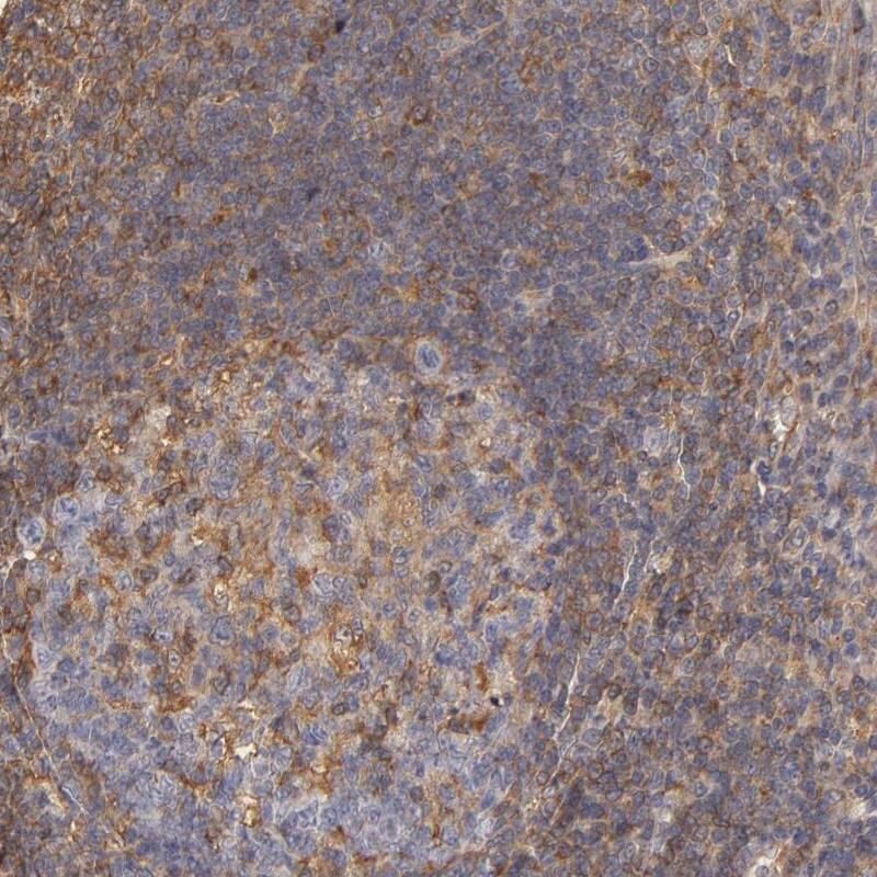 Staining of human tonsil shows moderate cytoplasmic positivity in subset of germinal center cells and non-germinal center cells.