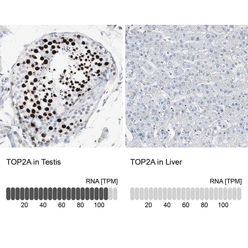 <b>Orthogonal Strategies Validation. </b>Analysis in human testis and liver tissues Corresponding TOP2A RNA-seq data are presented for the same tissues.