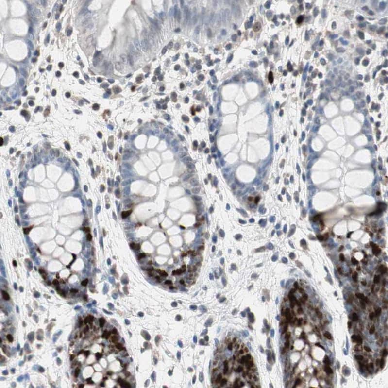 Staining of human colon shows strong nuclear positivity in glandular cells.