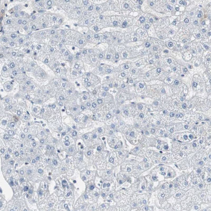 Staining of human liver shows no positivity in hepatocytes as expected.