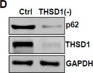 Western Blot THSD1 Antibody - BSA Free