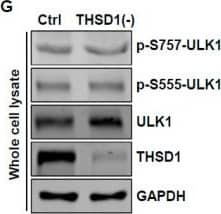 THSD1-mediated autophagy is independent of mTOR or AMPK pathway. (A–C) Western blot analysis of whole cell lysates (WCL) from control or THSD1-deficient HBMECs using antibodies against p-S6K-T389, S6K, p-4E-BP1-37/46, and 4E-BP1. GAPDH served as a loading control. Quantification of p-S6K-T389 (B) and p-4E-BP1-T37/46 (C) levels was analyzed by Student’s t-test (n = 3 independent experiments). (D–I) Representative Western blots of WCL from control or THSD1-deficient HBMECs for analyzing AMPK signaling (D–F) or ULK1 activation (G–I). Quantification of p-AMPK alpha -T172 (E), p-ACC-S79 (F), p-ULK1-S757, and p-ULK1-S555 was analyzed by Student’s t-test (n = 3 independent experiments). ns: not significant. Image collected and cropped by CiteAb from the following open publication (//www.mdpi.com/1422-0067/25/4/2139), licensed under a CC-BY license. Not internally tested by Novus Biologicals.