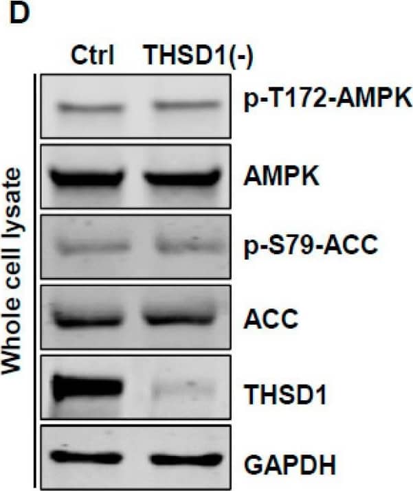THSD1-mediated autophagy is independent of mTOR or AMPK pathway. (A–C) Western blot analysis of whole cell lysates (WCL) from control or THSD1-deficient HBMECs using antibodies against p-S6K-T389, S6K, p-4E-BP1-37/46, and 4E-BP1. GAPDH served as a loading control. Quantification of p-S6K-T389 (B) and p-4E-BP1-T37/46 (C) levels was analyzed by Student’s t-test (n = 3 independent experiments). (D–I) Representative Western blots of WCL from control or THSD1-deficient HBMECs for analyzing AMPK signaling (D–F) or ULK1 activation (G–I). Quantification of p-AMPK alpha -T172 (E), p-ACC-S79 (F), p-ULK1-S757, and p-ULK1-S555 was analyzed by Student’s t-test (n = 3 independent experiments). ns: not significant. Image collected and cropped by CiteAb from the following open publication (//www.mdpi.com/1422-0067/25/4/2139), licensed under a CC-BY license. Not internally tested by Novus Biologicals.