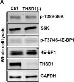 THSD1-mediated autophagy is independent of mTOR or AMPK pathway. (A–C) Western blot analysis of whole cell lysates (WCL) from control or THSD1-deficient HBMECs using antibodies against p-S6K-T389, S6K, p-4E-BP1-37/46, and 4E-BP1. GAPDH served as a loading control. Quantification of p-S6K-T389 (B) and p-4E-BP1-T37/46 (C) levels was analyzed by Student’s t-test (n = 3 independent experiments). (D–I) Representative Western blots of WCL from control or THSD1-deficient HBMECs for analyzing AMPK signaling (D–F) or ULK1 activation (G–I). Quantification of p-AMPK alpha -T172 (E), p-ACC-S79 (F), p-ULK1-S757, and p-ULK1-S555 was analyzed by Student’s t-test (n = 3 independent experiments). ns: not significant. Image collected and cropped by CiteAb from the following open publication (//www.mdpi.com/1422-0067/25/4/2139), licensed under a CC-BY license. Not internally tested by Novus Biologicals.
