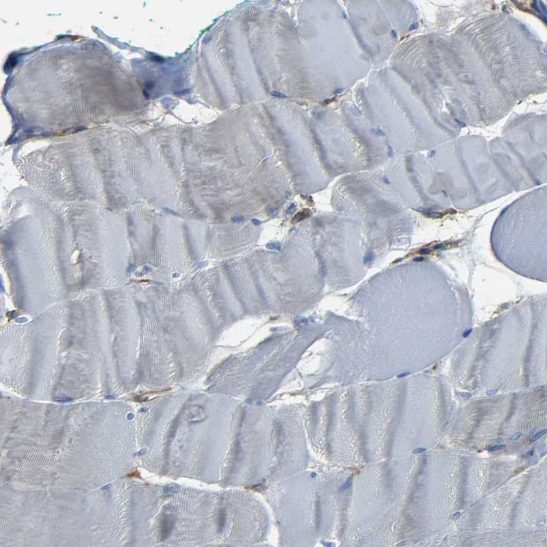 Staining of human skeletal muscle shows no positivity in myocytes as expected.