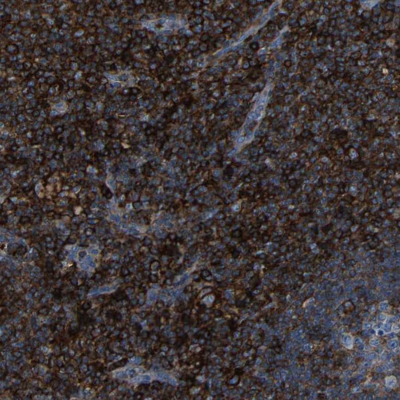 Staining of human lymph node shows strong membranous positivity in non-germinal center cells.
