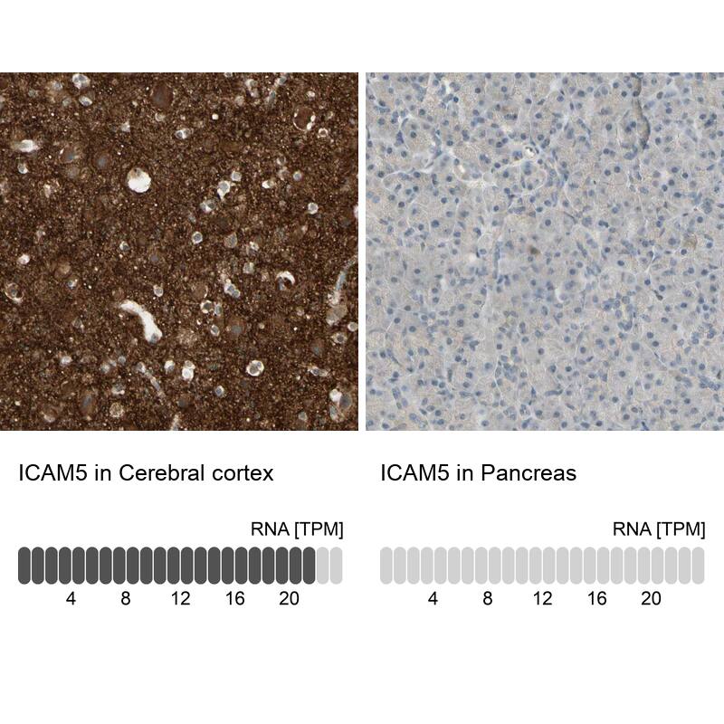 <b>Orthogonal Strategies Validation. </b>Analysis in human cerebral cortex and pancreas tissues using Anti-ICAM5 antibody. Corresponding ICAM5 RNA-seq data are presented for the same tissues.