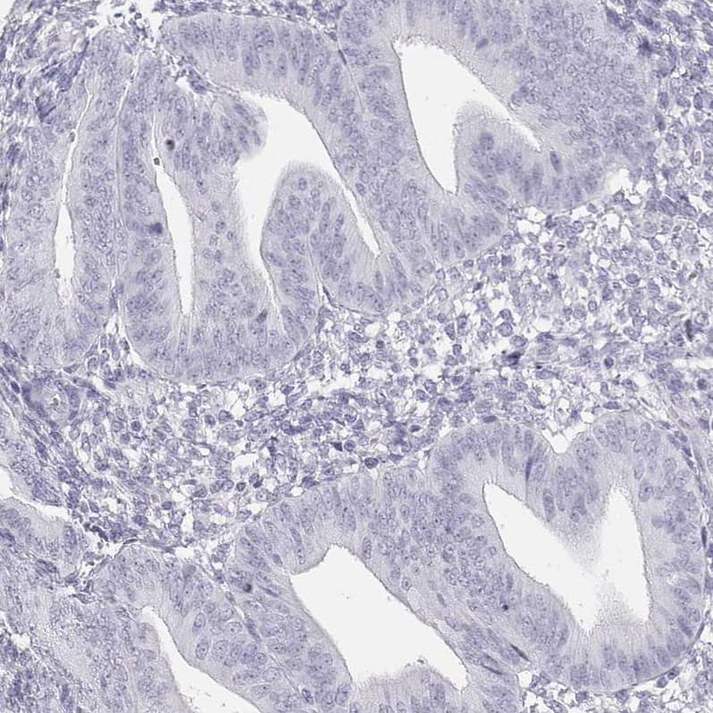 Immunohistochemistry-Paraffin TKTL1 Antibody - BSA Free