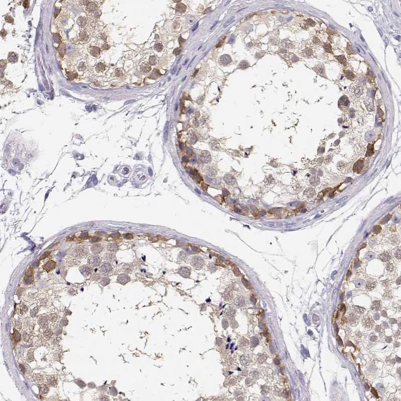 Immunohistochemistry-Paraffin TKTL1 Antibody - BSA Free