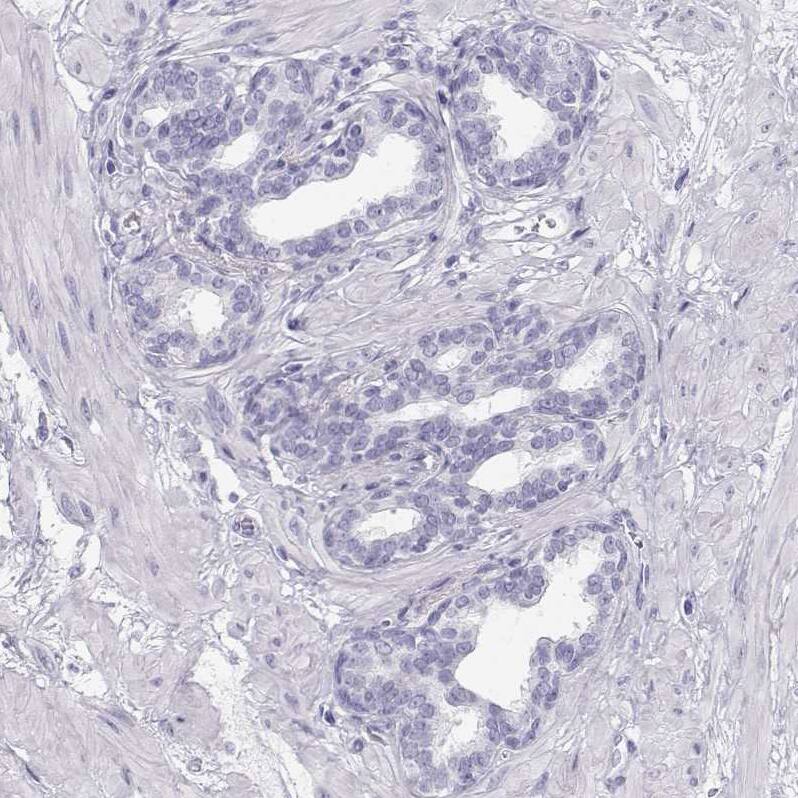 Immunohistochemistry-Paraffin TKTL1 Antibody - BSA Free