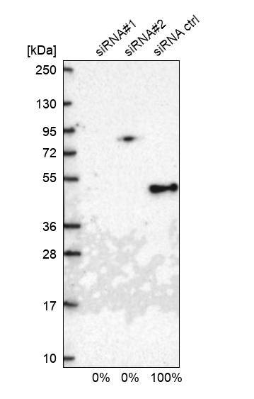 <b>Genetic Strategies Validation. </b>Analysis in U2OS cells transfected with control siRNA, target specific siRNA probe #1 and #2, using Anti-TIMM44 antibody. Remaining relative intensity is presented