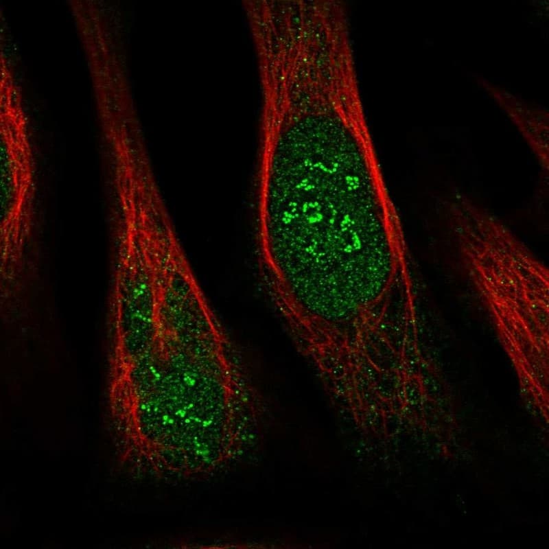 Staining of human cell line U-2 OS shows localization to nucleus & nucleoli fibrillar center.