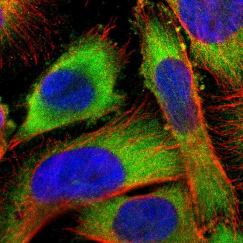 Staining of human cell line U-251 MG shows localization to cytosol.