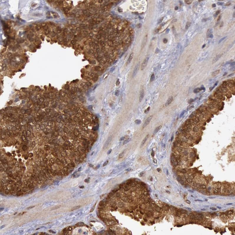 Staining of human prostate shows strong cytoplasmic and membranous positivity in glandular cells.