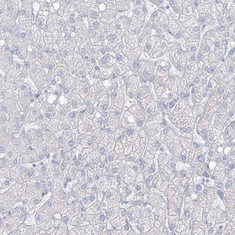 Staining of human Liver shows no positivity in hepatocytes as expected.