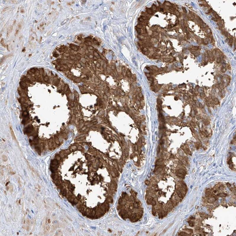 Staining of human Prostate shows strong granular cytoplasmic positivity in glandular cells.