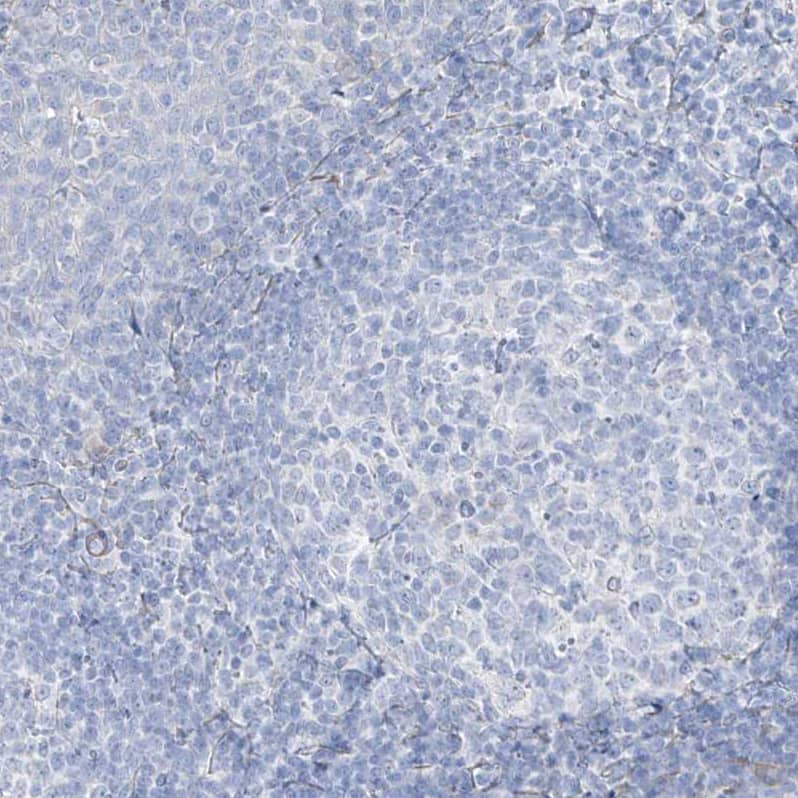 Staining of human Tonsil shows no positivity in non-germinal center cells as expected.