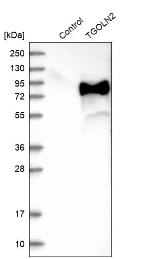 Analysis in control (vector only transfected HEK293T lysate) and TGOLN2 over-expression lysate (Co-expressed with a C-terminal myc-DDK tag (~3.1 kDa) in mammalian HEK293T cells).