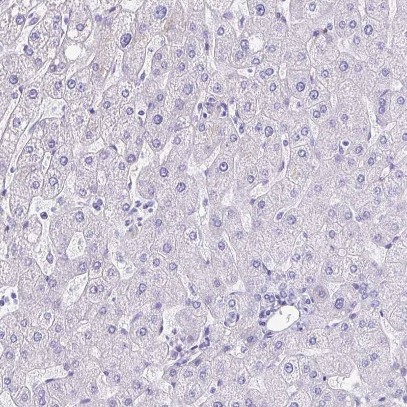 Immunohistochemistry-Paraffin Transglutaminase 3/TGM3 Antibody - BSA Free