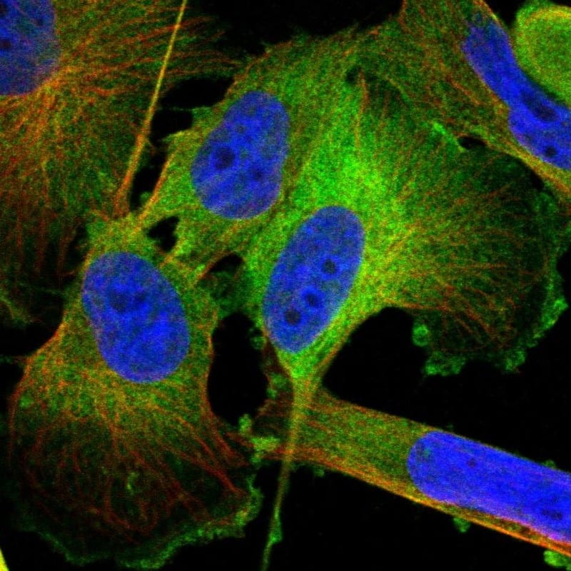 Staining of human cell line U-251 MG shows localization to plasma membrane & cytosol.