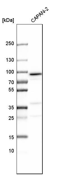 Analysis in human cell line CAPAN-2.
