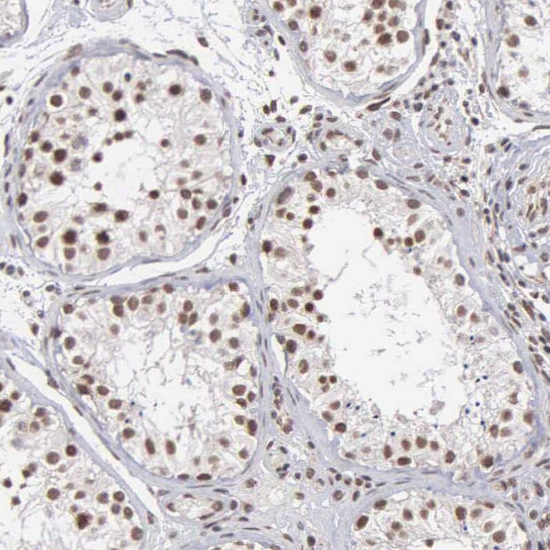 Staining of human testis shows strong nuclear positivity in cells in seminiferous ducts.