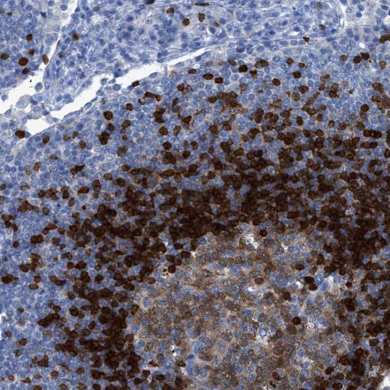 Staining of human lymph node shows moderate to strong cytoplasmic positivity in lymphoid cells.