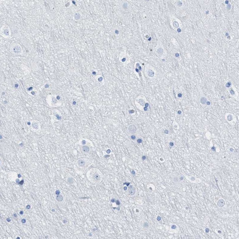 Immunohistochemistry-Paraffin TCL1A Antibody