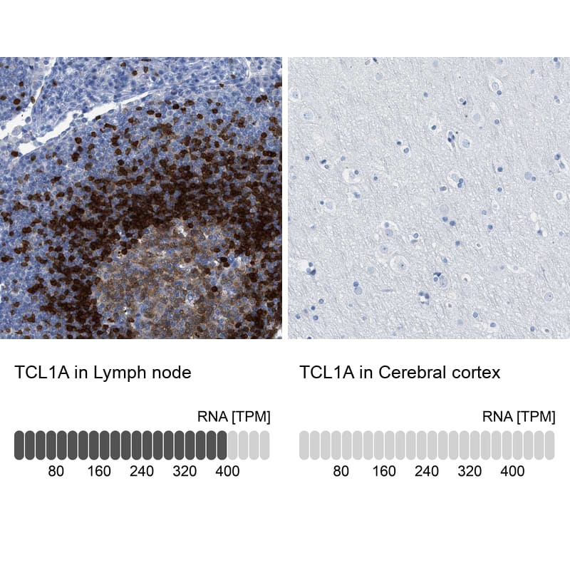 Immunohistochemistry-Paraffin TCL1A Antibody
