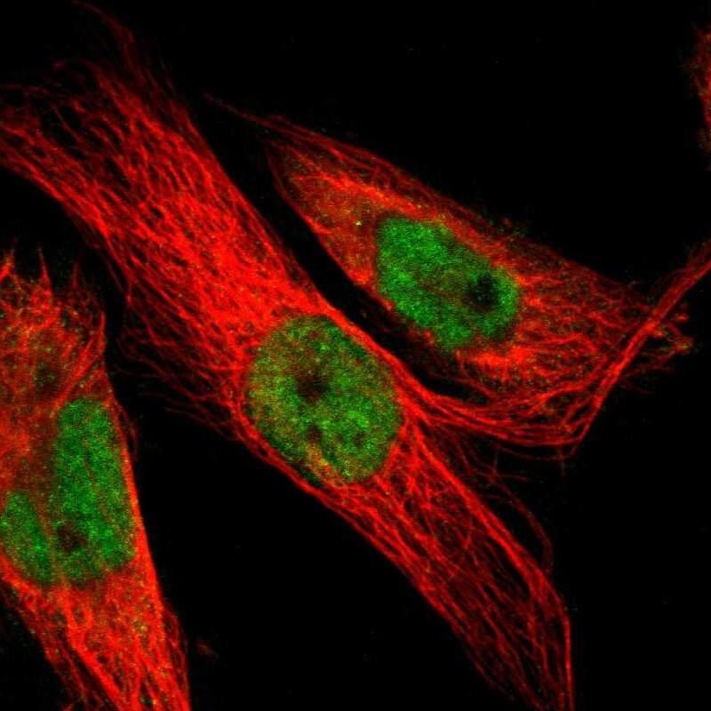 Staining of human cell line U-251 MG shows localization to nucleoplasm & cytosol.