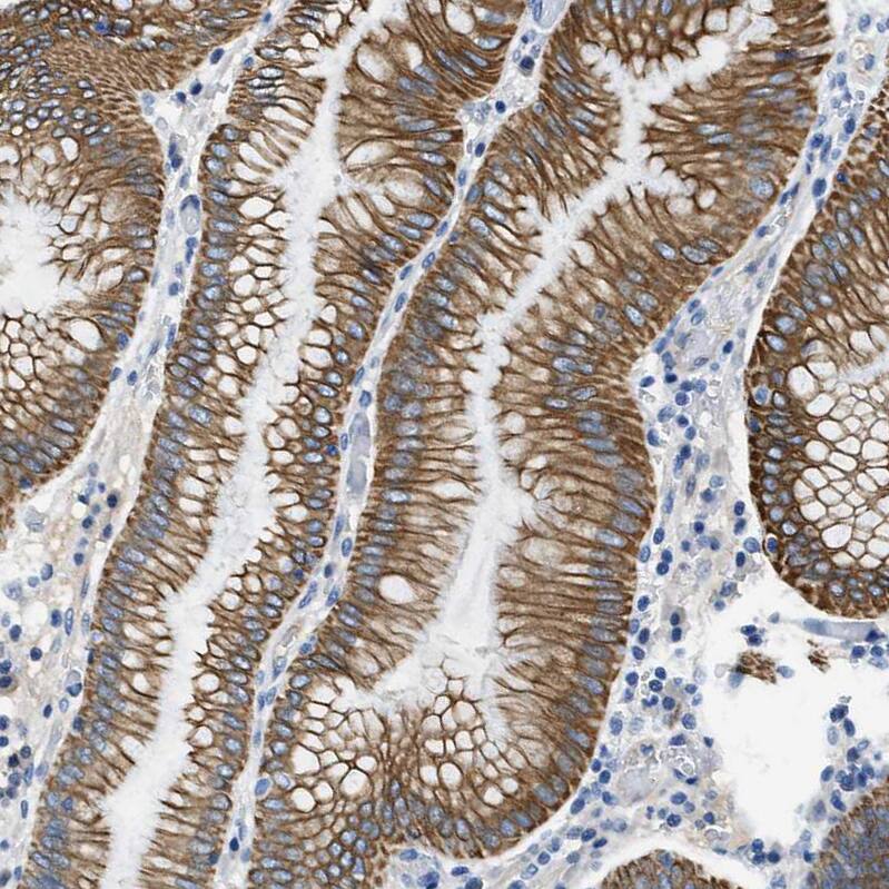 Staining of human Stomach shows strong membranous positivity in glandular cells.