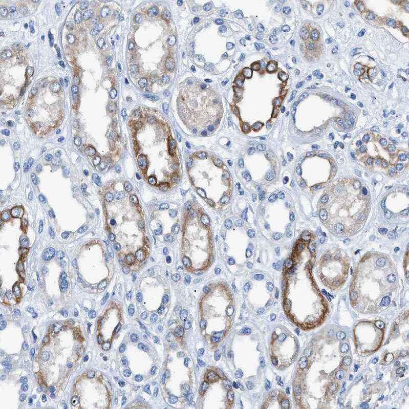 Staining of human Kidney shows weak to moderate membranous positivity in cells in tubules.