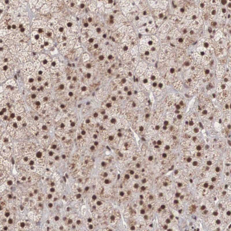 Immunohistochemistry-Paraffin HIV-1 Tat specific factor 1 Antibody - BSA Free
