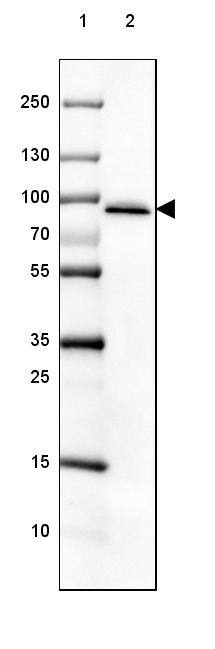 Lane 1: Marker [kDa] 250, 130, 100, 70, 55, 35, 25, 15, 10Lane 2: Human Adrenal Gland tissue
