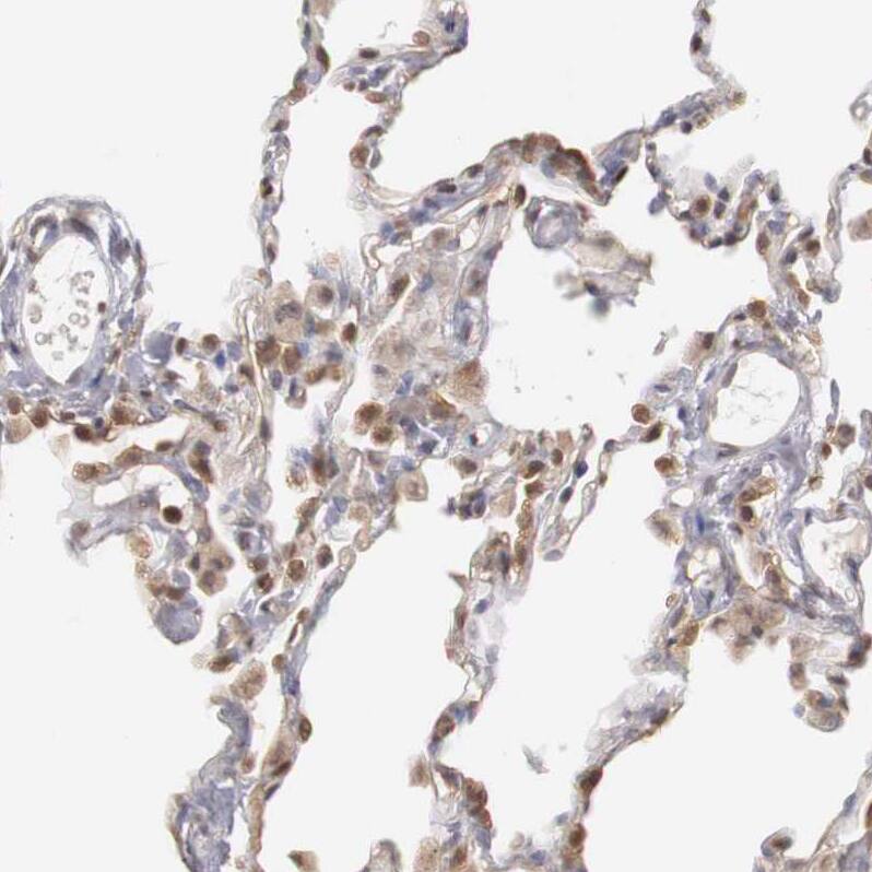 Staining of human lung shows moderate nuclear and cytoplasmic positivity in pneumocytes.