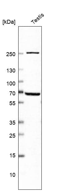 Analysis in human testis tissue.
