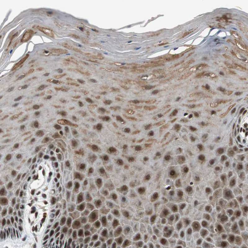 Staining of human cervix shows strong nuclear positivity in squamous epithelial cells.