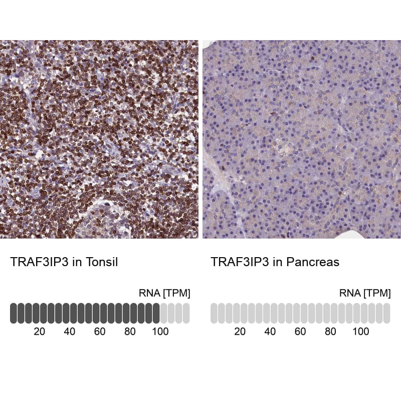 Immunohistochemistry-Paraffin TRAF3IP3 Antibody - BSA Free