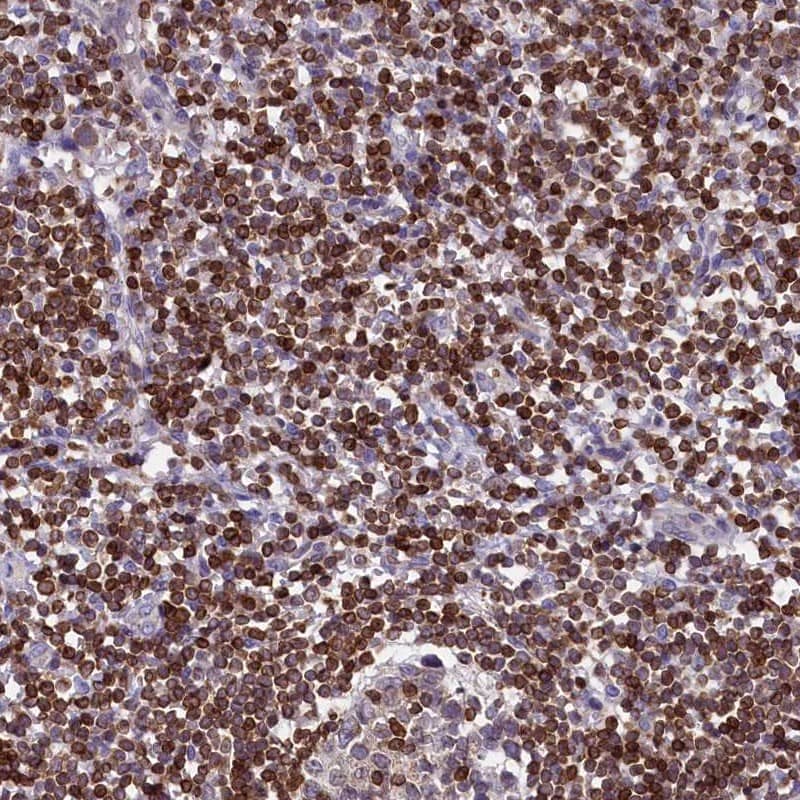 Immunohistochemistry-Paraffin TRAF3IP3 Antibody - BSA Free