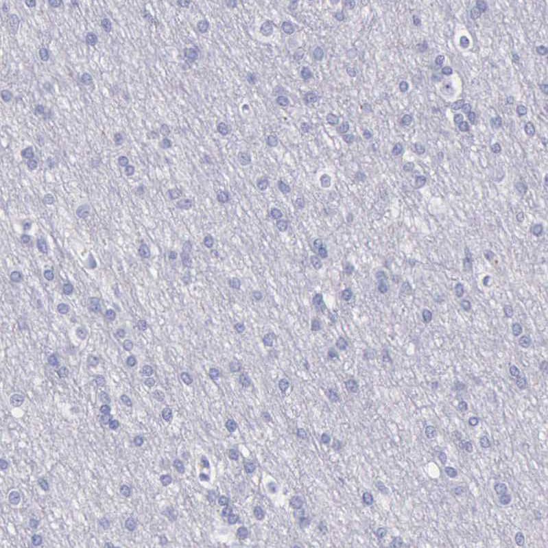 Immunohistochemistry-Paraffin Cystatin A Antibody - BSA Free