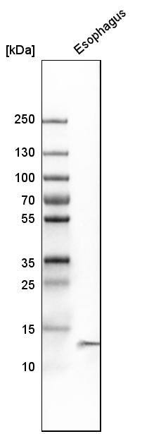 Western Blot Cystatin A Antibody - BSA Free