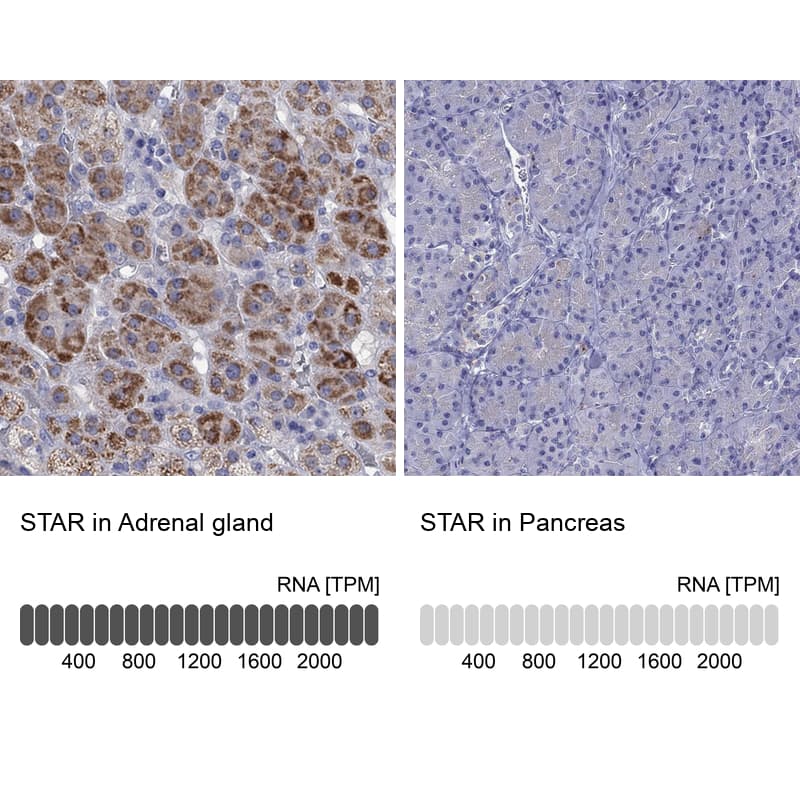 <b>Independent Antibodies Validation and Orthogonal Strategies Validation.</b>Analysis in human adrenal gland and pancreas tissues using Anti-STAR antibody. Corresponding STAR RNA-seq data are presented for the same tissues.