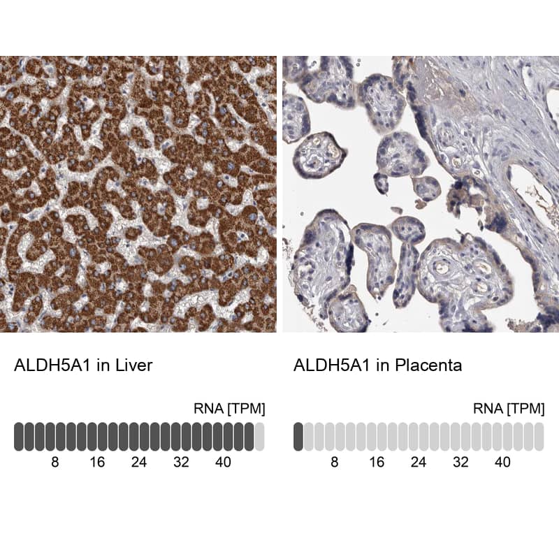 Immunohistochemistry-Paraffin ALDH5A1 Antibody - BSA Free