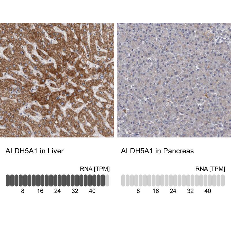 <b>Independent Antibodies Validation and Orthogonal Strategies Validation.</b>Analysis in human liver and pancreas tissues.