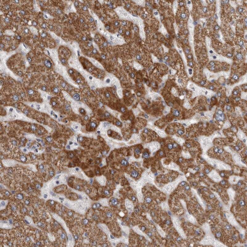Staining of human liver shows high expression.