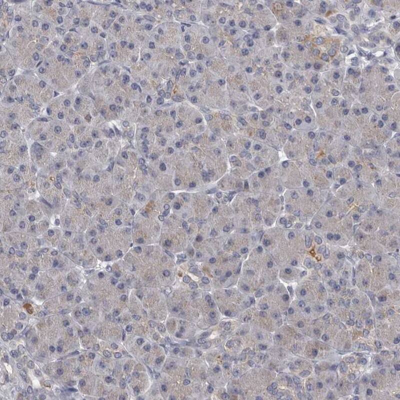 Staining of human pancreas shows low expression as expected.